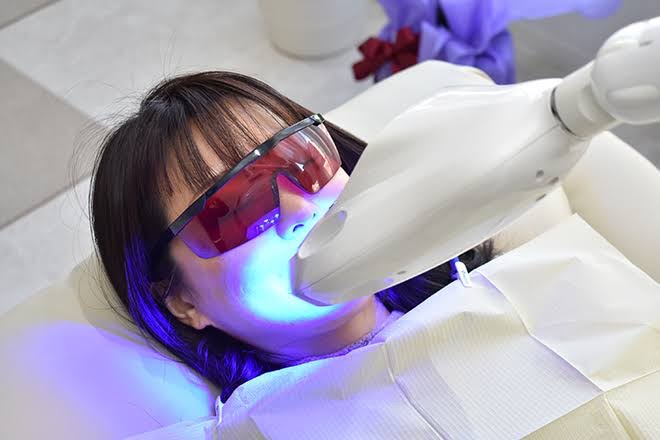 セルフホワイトニング